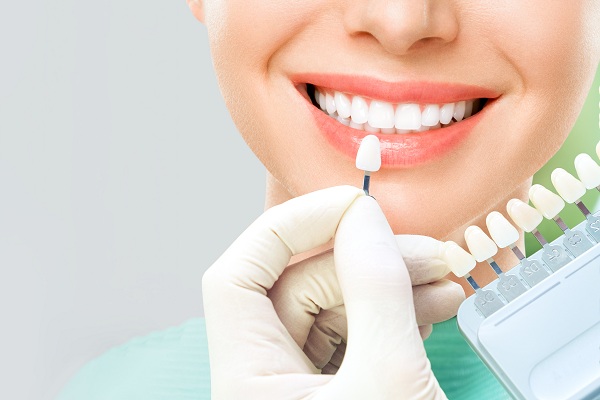 Teeth Whitening